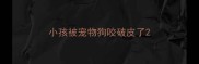 小孩被宠物狗咬破皮了