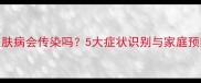 狗狗皮肤病会传染吗5大症状识别与家庭预防指南