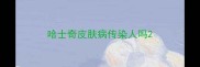 哈士奇皮肤病传染人吗