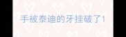 手被泰迪的牙挂破了