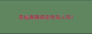 泰迪真菌感染传染人吗