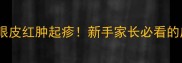 两个月大哈士奇眼皮红肿起疹新手家长必看的皮肤护理全攻略