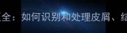哈士奇皮肤问题全如何识别和处理皮屑结痂及过敏症状
