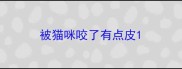 被猫咪咬了有点皮