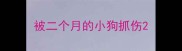 被二个月的小狗抓伤